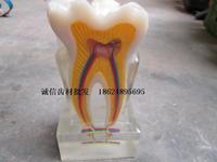 齿科模型 牙科模型 牙齿单体水晶剖面模型 口腔模型牙科齿科材料