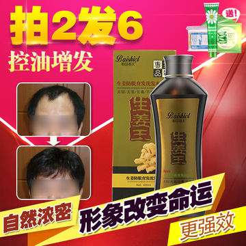 正品生姜洗发水防脱发生发液脂溢性产后增发密发无硅油头发增长液
